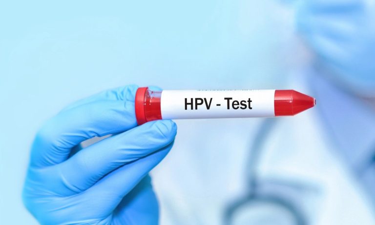 How Much Is STD Testing at Urgent Care Without Insurance