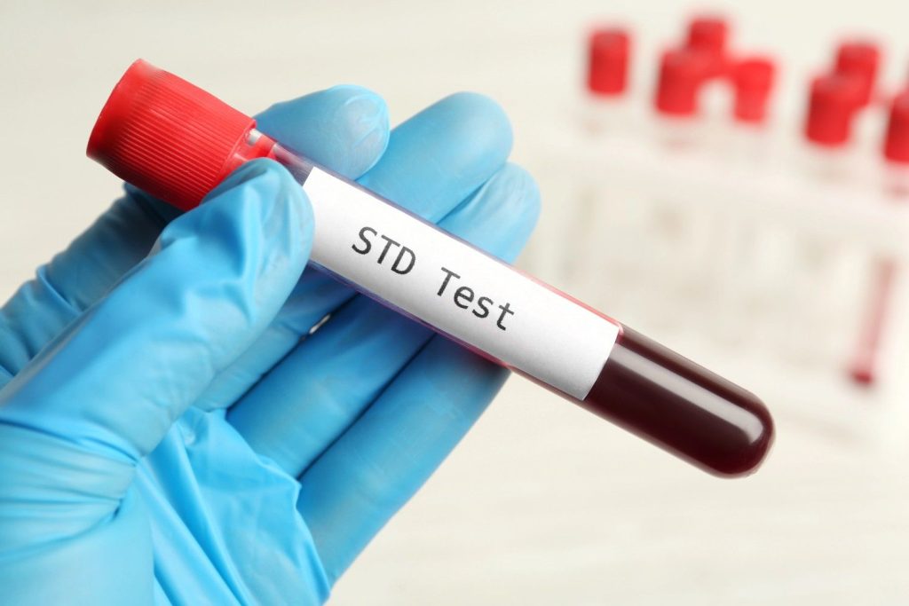 Close-up of a blood sample for an STD test, available at an STD testing clinic in Gulfton.
