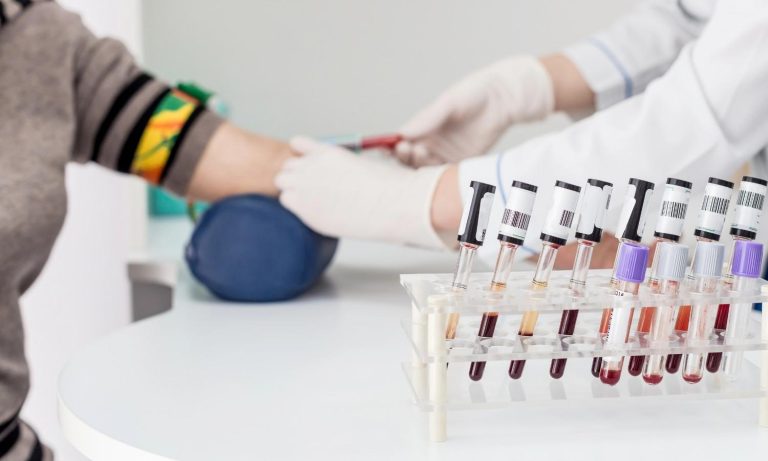 How Long Do STD Tests Take?