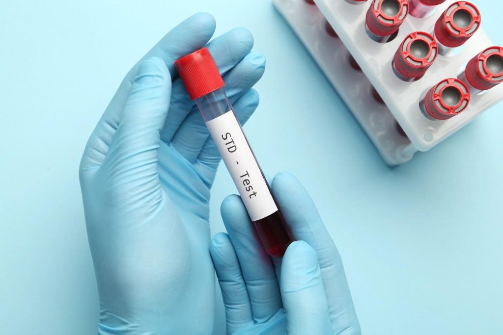 Close-up of a blood sample for an STD test, available at a cheap STD testing clinic in Shenandoah.