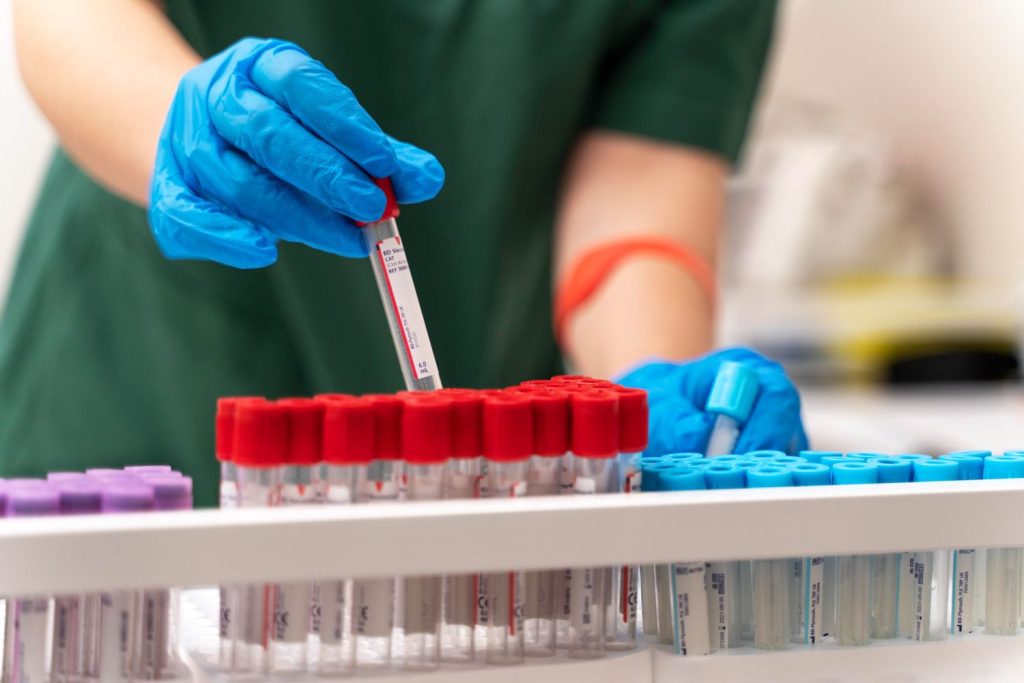 Same day STI test Houston: Lab technician handling blood sample vials for rapid STI analysis, ensuring fast results in a sterile lab environment.