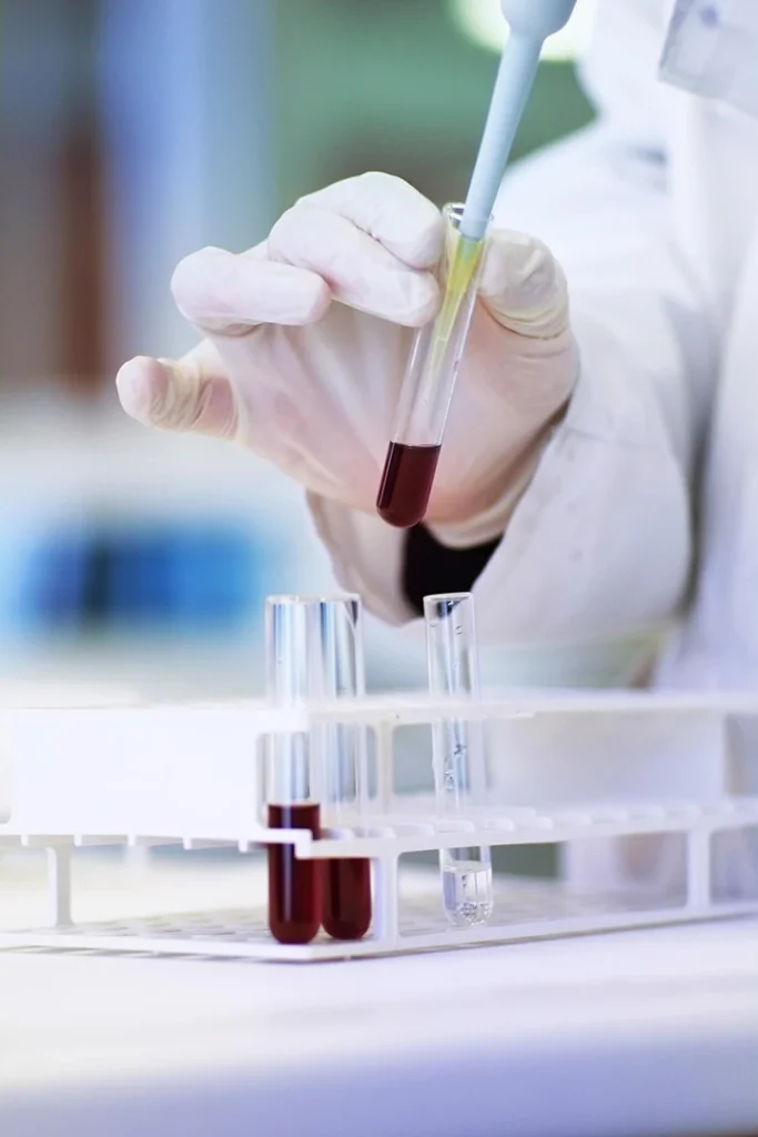 Lab tech preparing samples for quick and affordable STD testing Houston services.