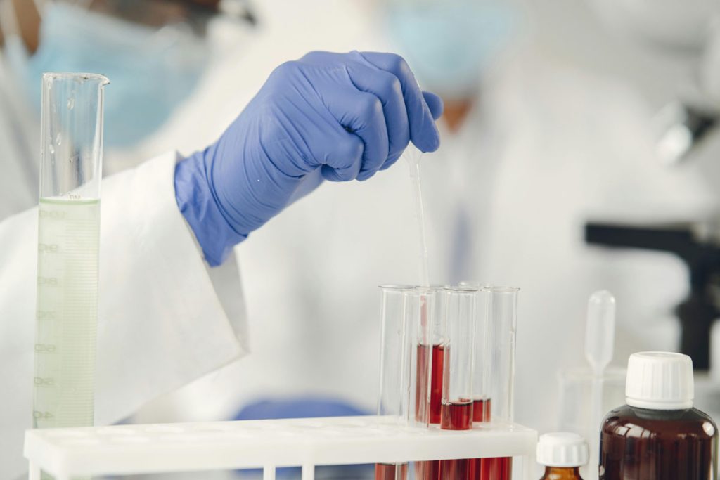 Professional lab processing blood work for reliable Walk In STD Testing Houston.