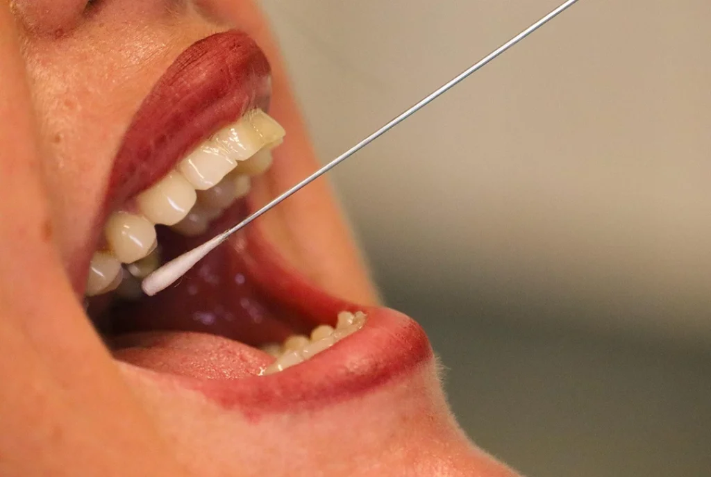 Close-up of an oral swab sample collection for quick and private same day STI test Houston.