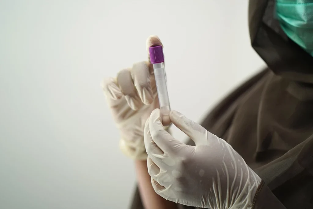 Gloved healthcare worker holding a medical sample tube for rapid same day STI test Houston results.