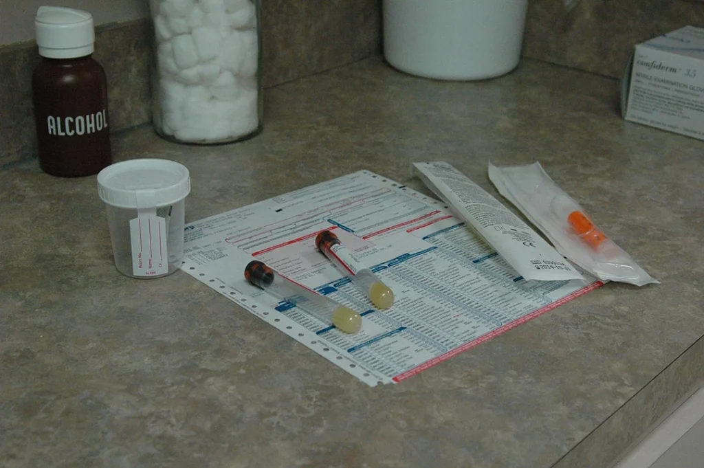Lab supplies for confidential sample collection and processing for same day STI test Houston.