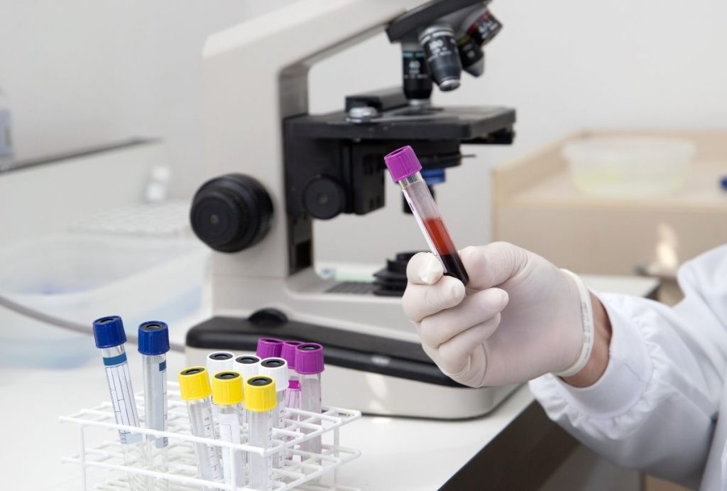 Gloved hand holding blood sample with purple cap near microscope in lab, supporting accurate and affordable std testing houston