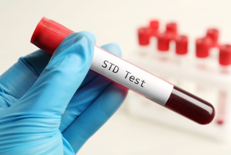Gloved hand holding blood vial labeled STD Test in lab, highlighting fast, confidential affordable std testing houston services