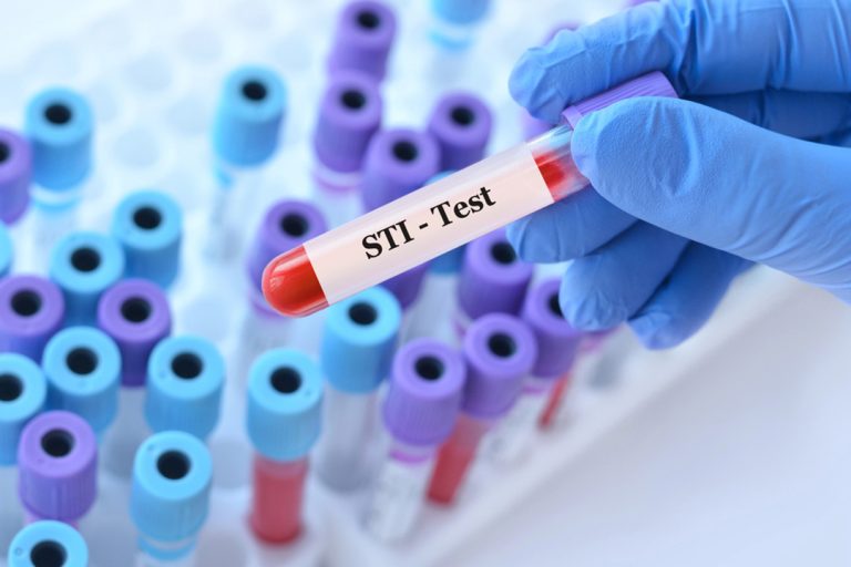 Gloved hand holding blood vial labeled STI - Test in lab, promoting fast, confidential sti testing houston services for public health