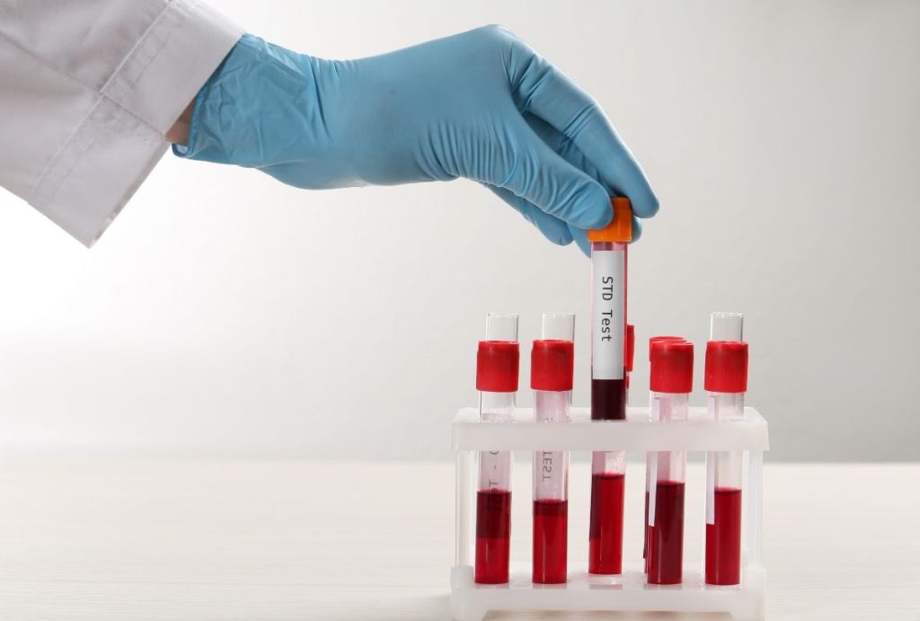 Gloved hand holding 'STD Test' blood tube over lab rack, highlighting affordable std testing houston with fast, confidential results