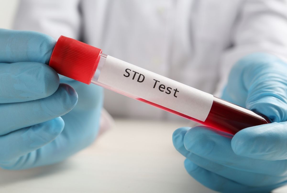 What Is The Fastest Way To Get STD Tested Near Rice Village? | Advanced ...
