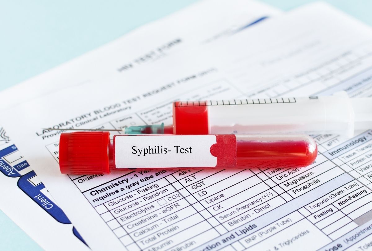 Best STD testing Houston includes syphilis blood test with lab request form for accurate diagnosis and fast results.