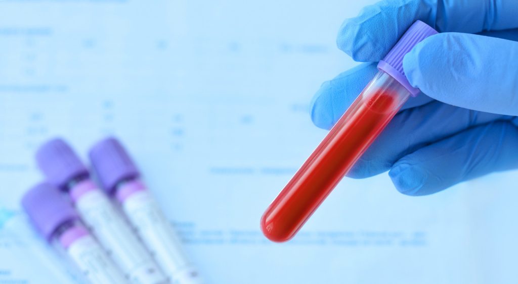 Doctor reviews accurate and confidential blood sample results from affordable STI testing Houston.