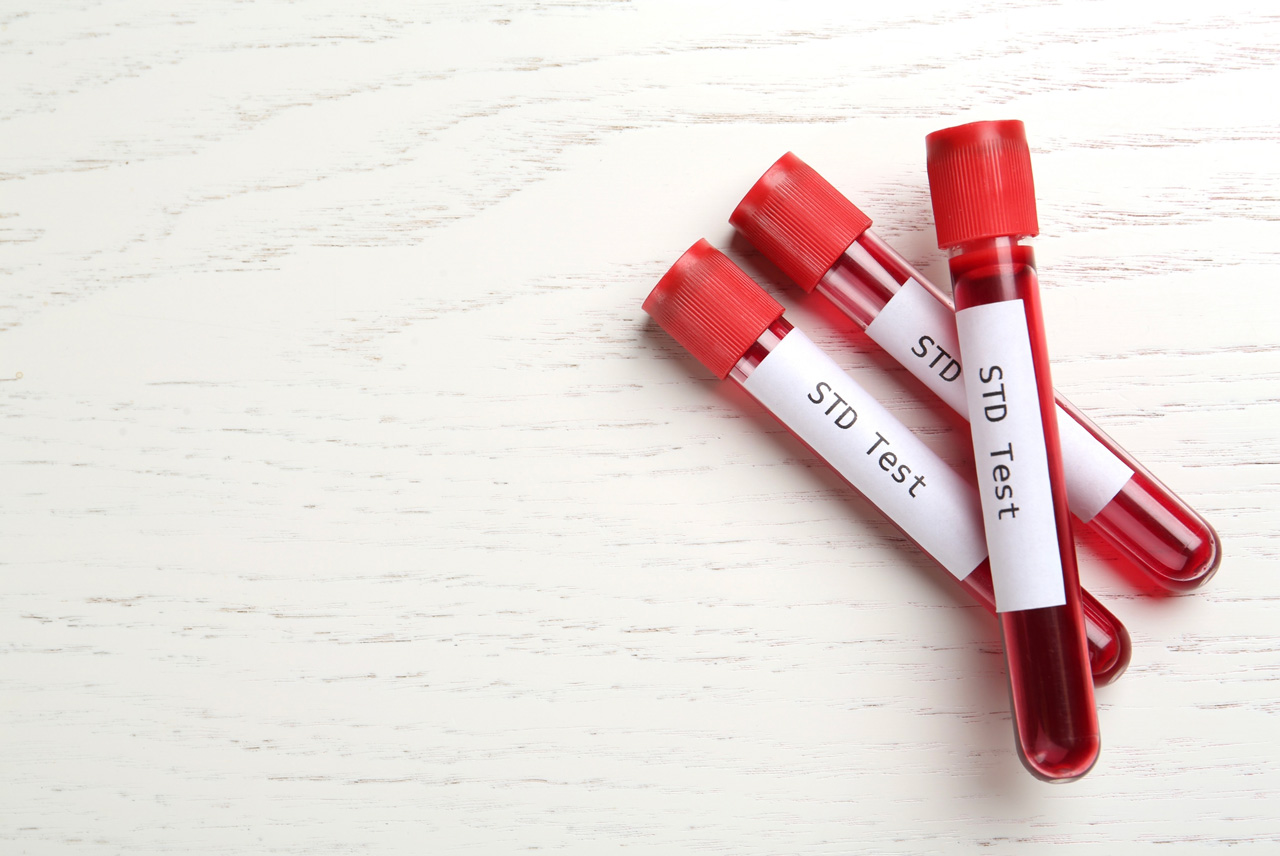 Secure and private collection tubes for comprehensive lab work and the best STD testing Houston has available.