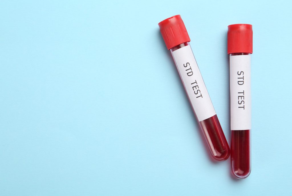 Two red-capped blood test tubes labeled 'STD Test' on a blue surface for cheap STD testing Houston.