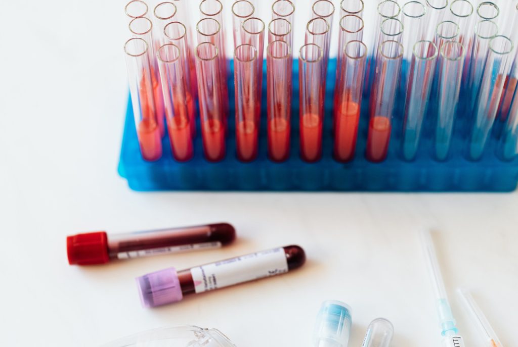 Laboratory tubes and blood collection vials ready for processing a same day std test houston at a local health lab.