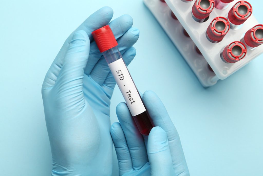 Professional in blue gloves holding a blood sample vial labeled for a same day std test houston medical screening.