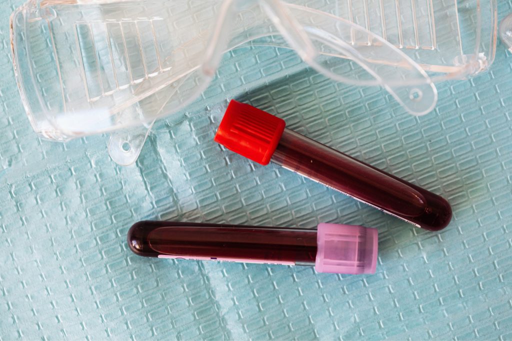 Medical equipment and blood vials for a same day std test houston clinic, shown on a sterile blue laboratory surface.