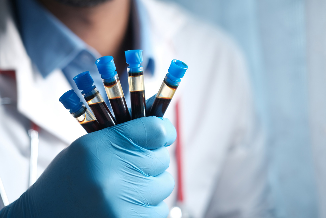 A medical professional in gloves holding blood samples for patients seeking reliable std testing houston clinic care.