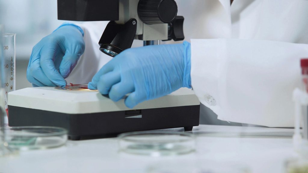 Technician preparing slide under microscope at an affordable STD testing Houston clinic for reliable lab analysis and discreet diagnostics