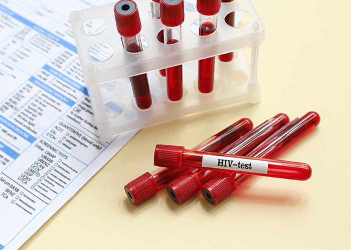 Blood collection tubes with red caps and HIV-test labels on a lab form, showing the process for HIV testing Houston.