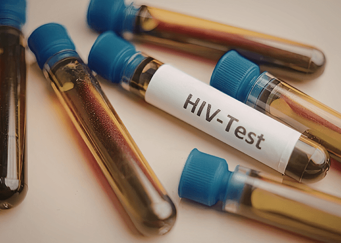 Professional laboratory vials prepared for HIV testing Houston, showing blood samples for diagnostic screening.