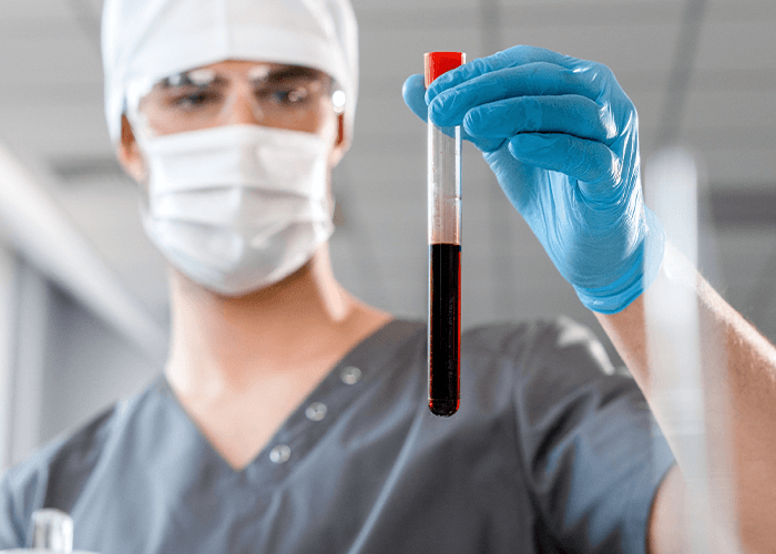 Lab technician in scrubs and mask holding a blood sample vial, providing reliable HIV testing Houston clinic services.