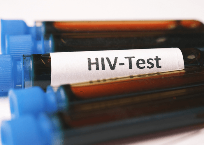 Close-up of medical blood vials with blue caps and an HIV-Test label, representing professional HIV testing Houston.