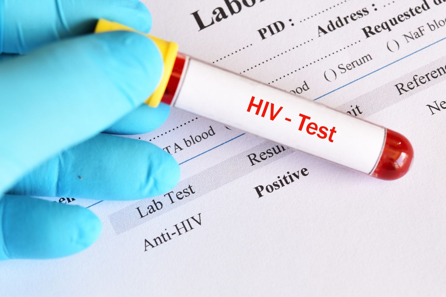 Hand in blue glove holding a positive HIV testing Houston blood vial over an official laboratory results document.
