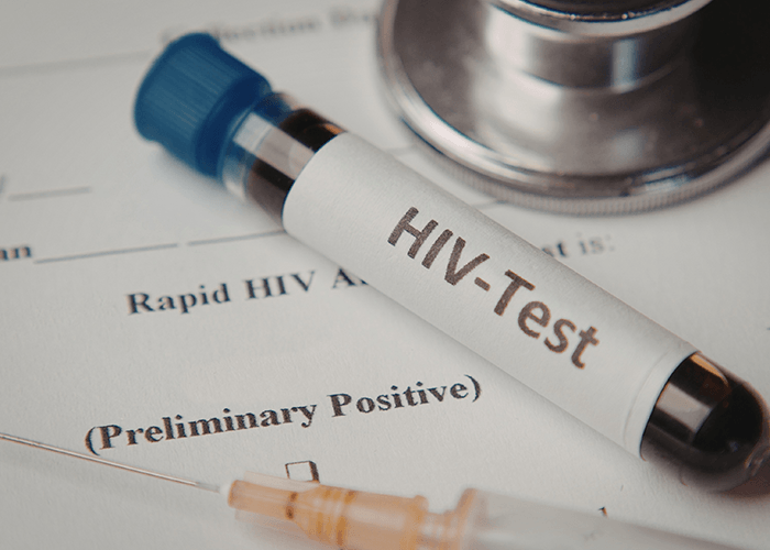 Rapid HIV testing Houston results showing a preliminary positive on a medical form with a stethoscope and syringe.