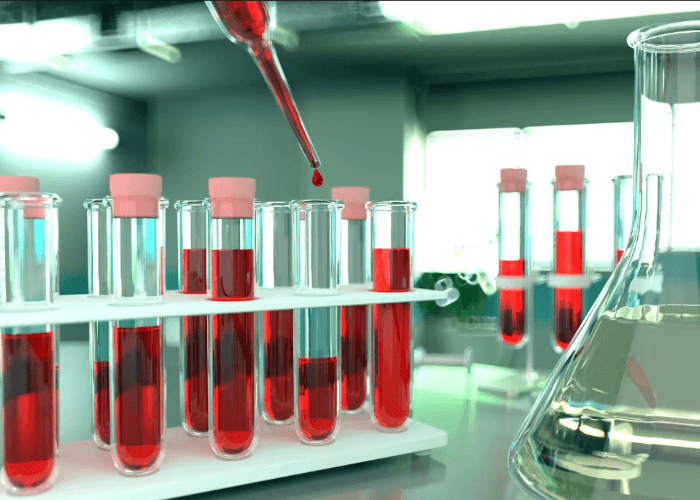 Blood samples in test tubes for confidential std testing houston are prepared for screening in a modern laboratory.